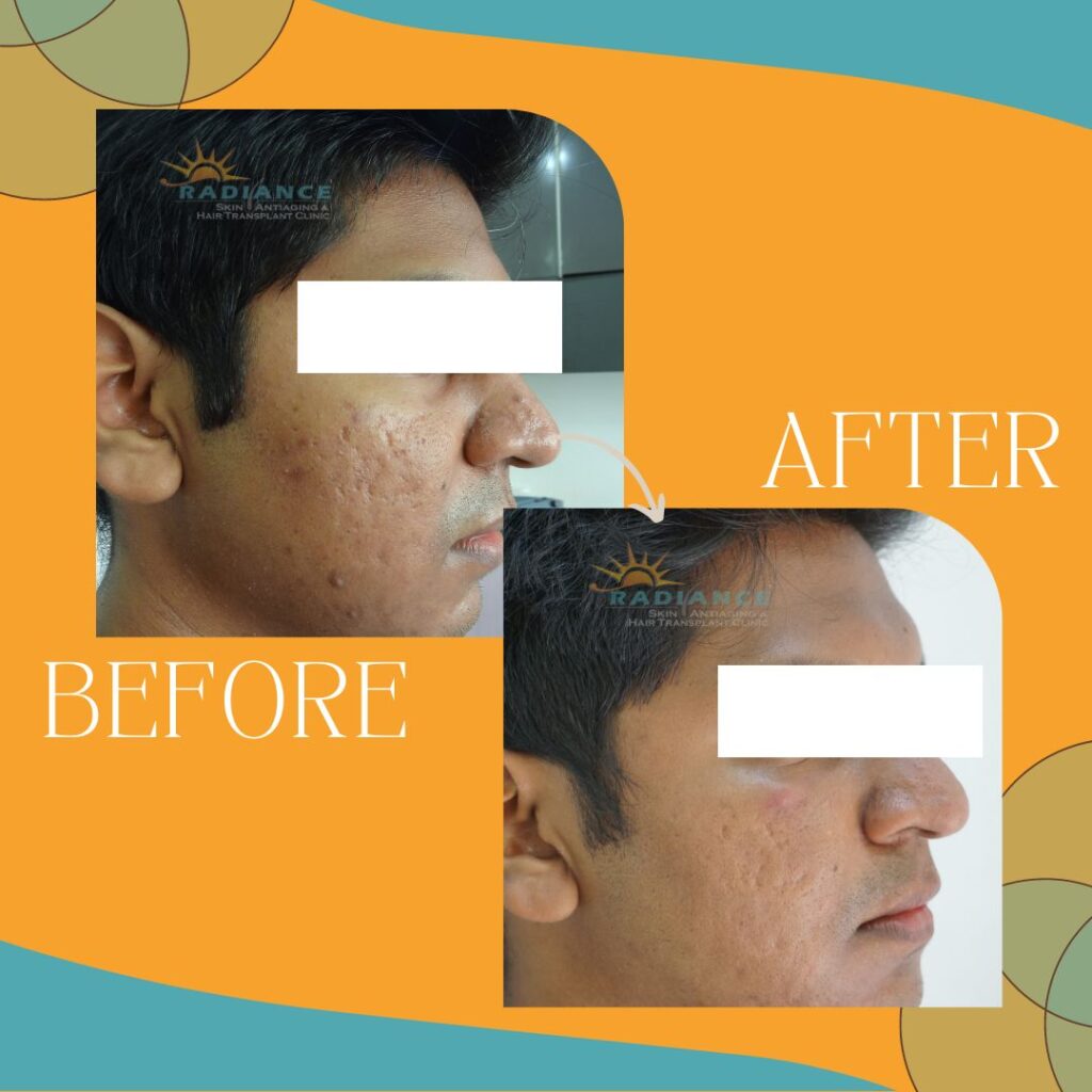 xr:d:DAFOVUqwLko:8,j:37351165332,t:22100706