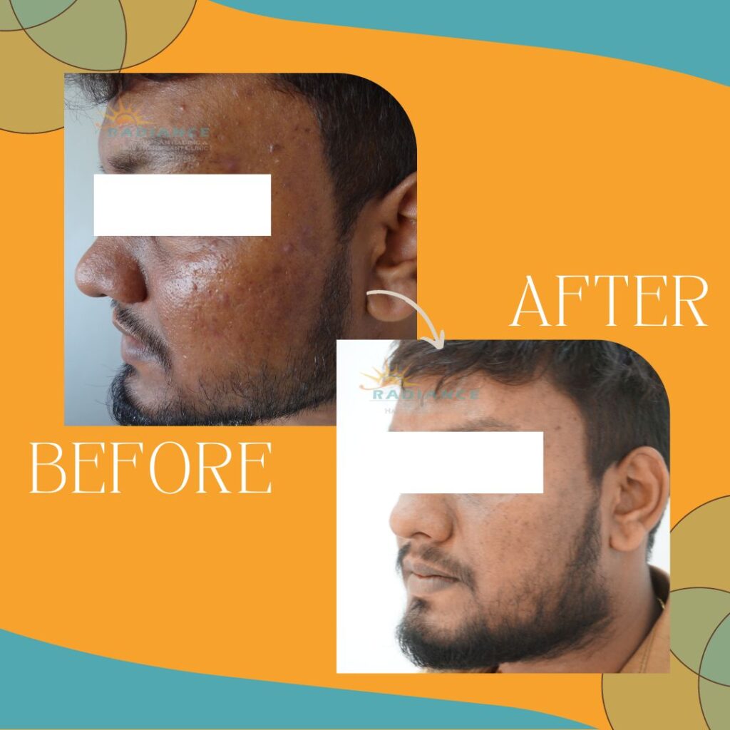 xr:d:DAFOVUqwLko:11,j:37351673284,t:22100706