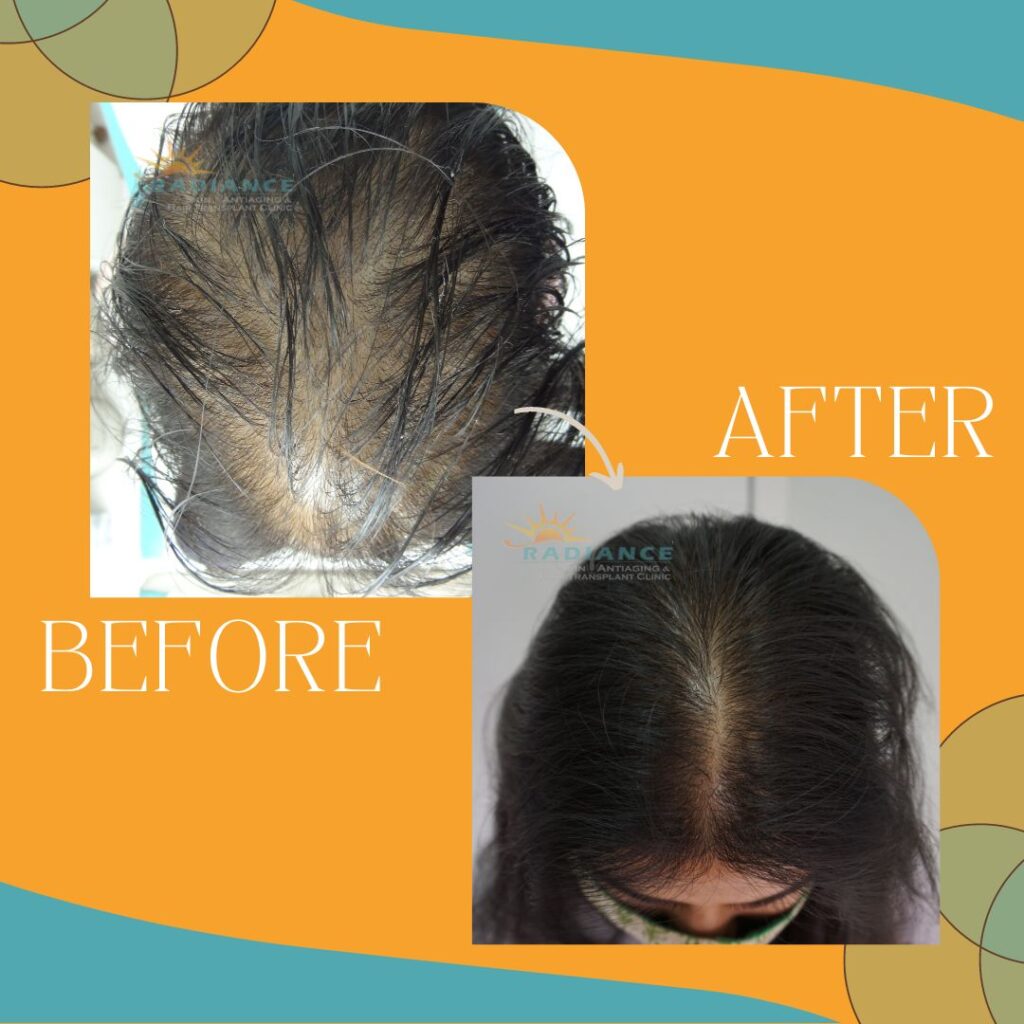 xr:d:DAFOVUqwLko:19,j:37353507489,t:22100706