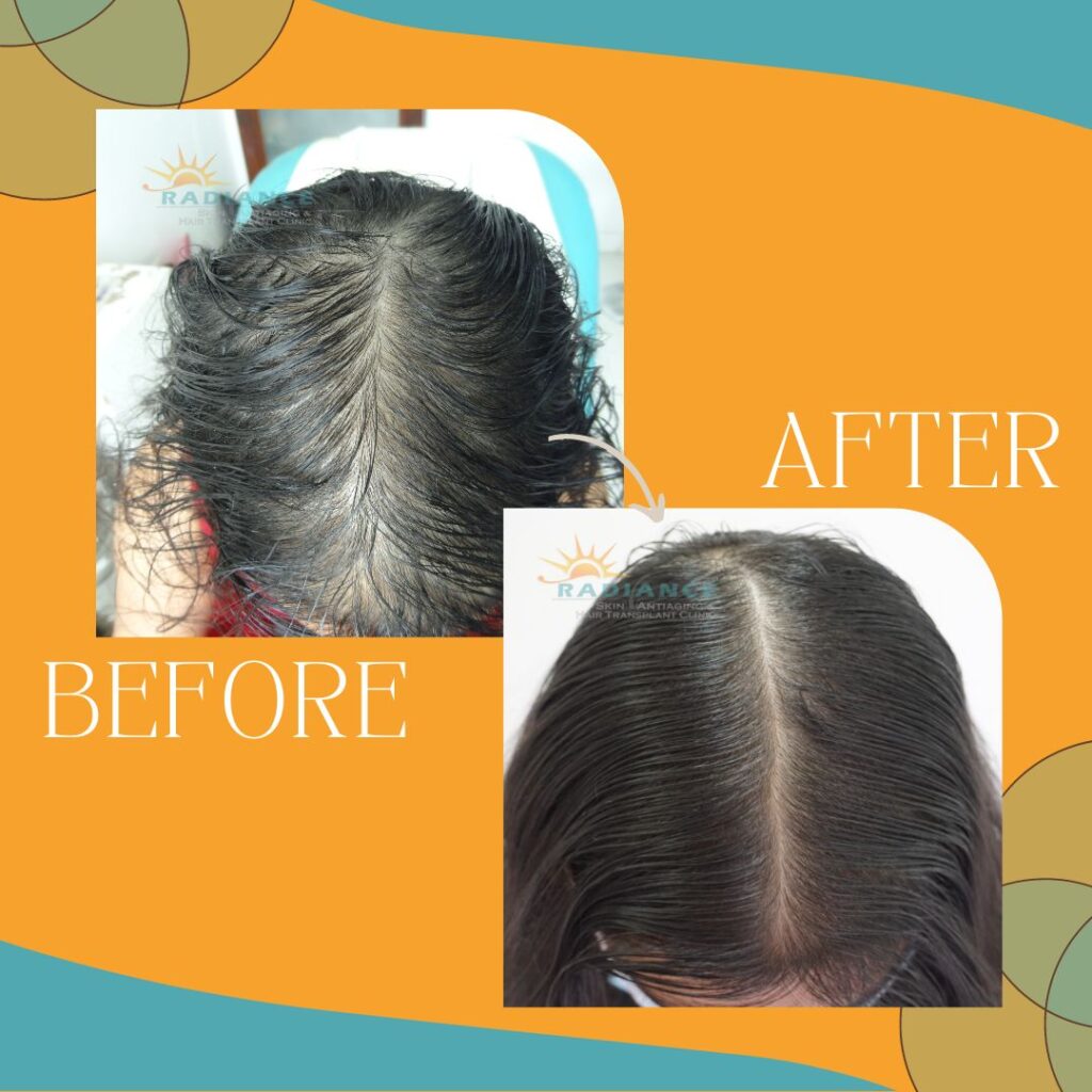 xr:d:DAFOVUqwLko:19,j:37353507489,t:22100706