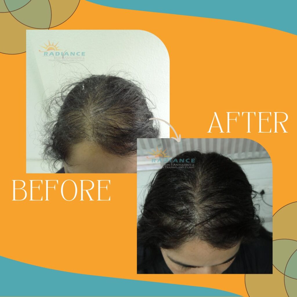 xr:d:DAFOVUqwLko:19,j:37353507489,t:22100706