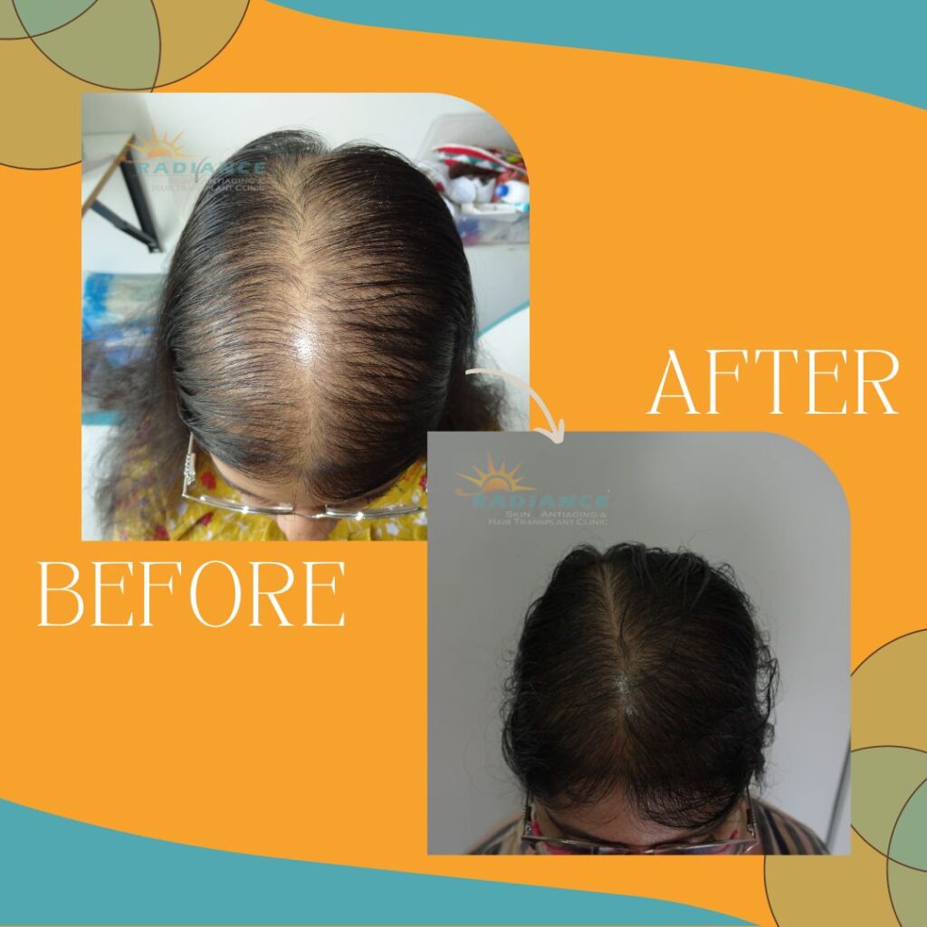 xr:d:DAFOVUqwLko:19,j:37353507489,t:22100706