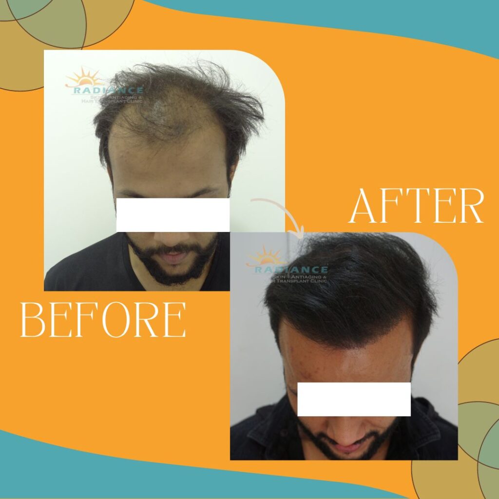 xr:d:DAFOVUqwLko:26,j:37354193162,t:22100707