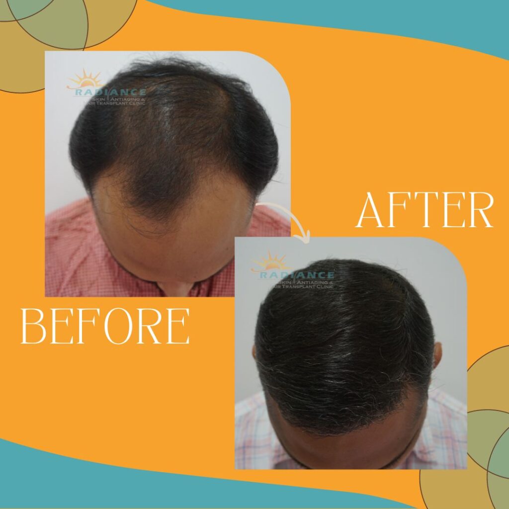 xr:d:DAFOVUqwLko:26,j:37354193162,t:22100707