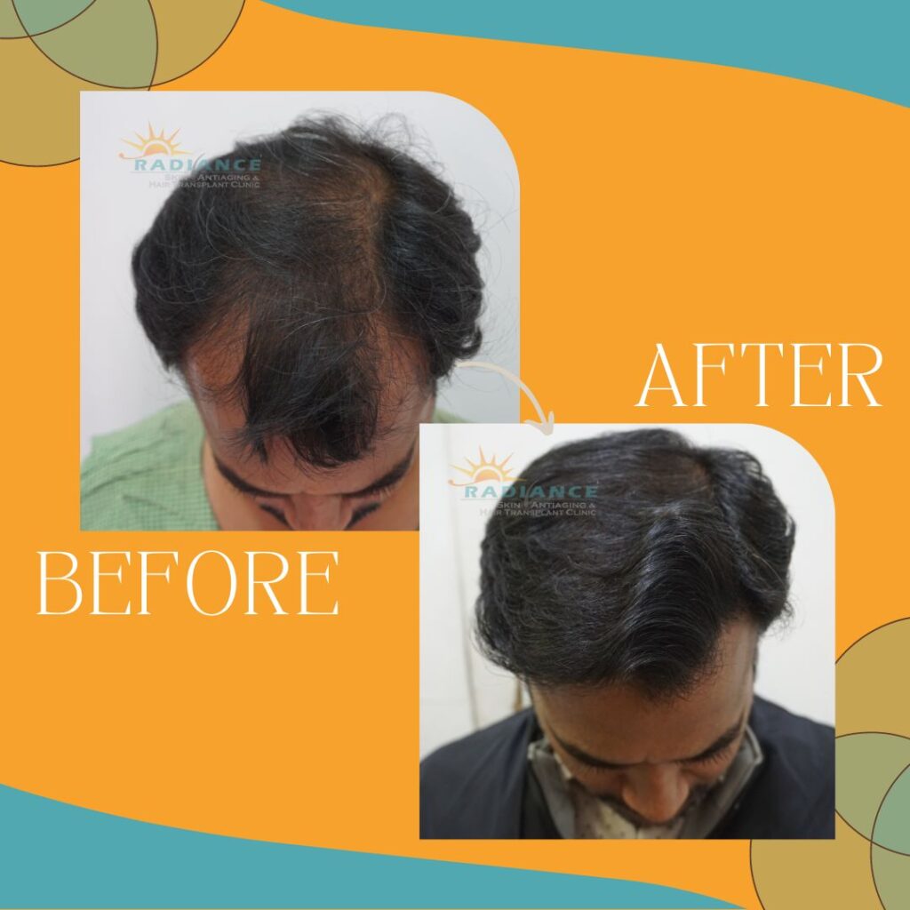 xr:d:DAFOVUqwLko:26,j:37354193162,t:22100707