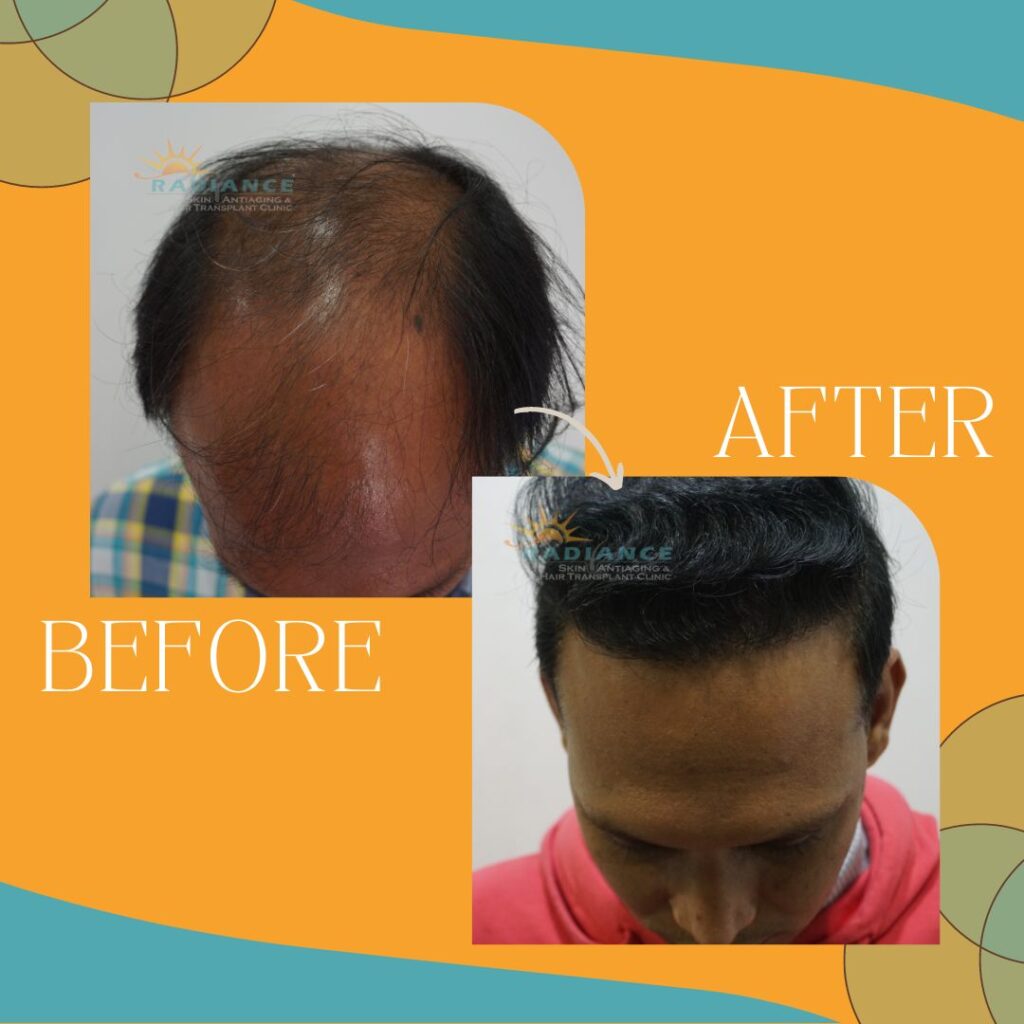 xr:d:DAFOVUqwLko:26,j:37354193162,t:22100707