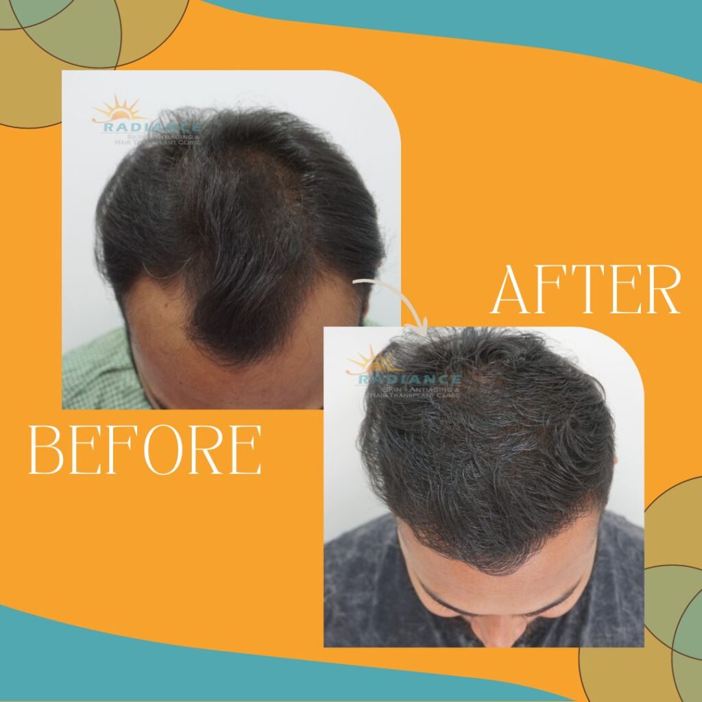 xr:d:DAFOVUqwLko:26,j:37354193162,t:22100707