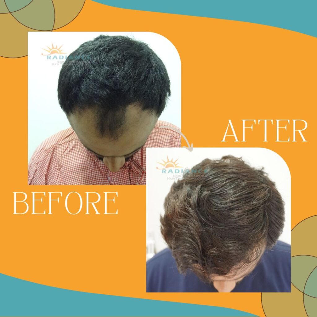 xr:d:DAFOVUqwLko:26,j:37354193162,t:22100707